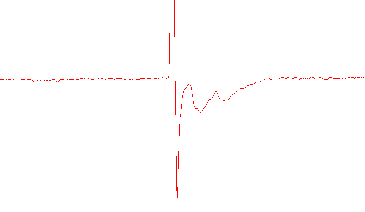 A screenshot of a recording with two currents after a stimulation. This is an example of multivesicular release.